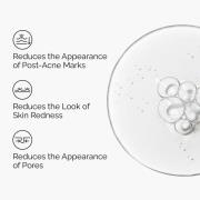 The Ordinary Aloe 2% + NAG 2% Solution Serum 30ml